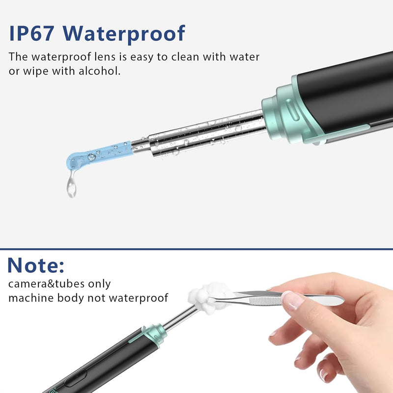 VITCOCO Ear Wax Removal Kit with 1920P FHD Camera, 3.9mm Waterproof Otoscope, and 8 Ear Spoons – Compatible with iPhone, iPad, and Android Devices